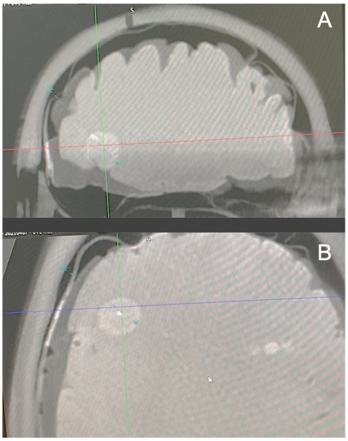 Figure 6