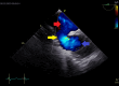 Figure 17