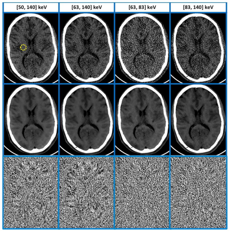 FIG. 13