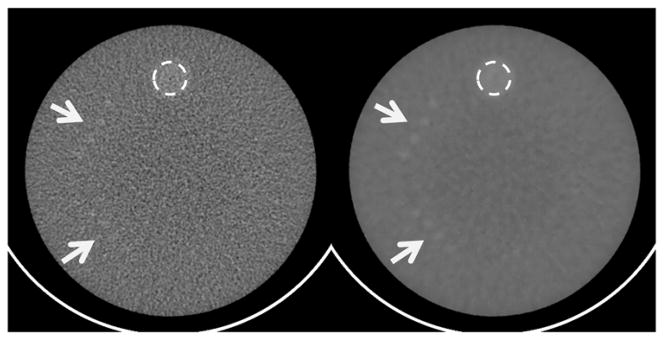 FIG. 10