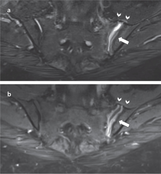 Figure 1. a, b.