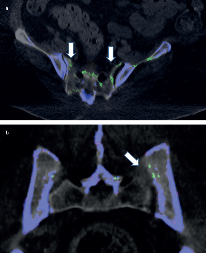 Figure 2. a, b.