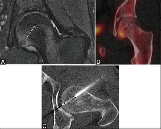 Figure 3 (A-C)