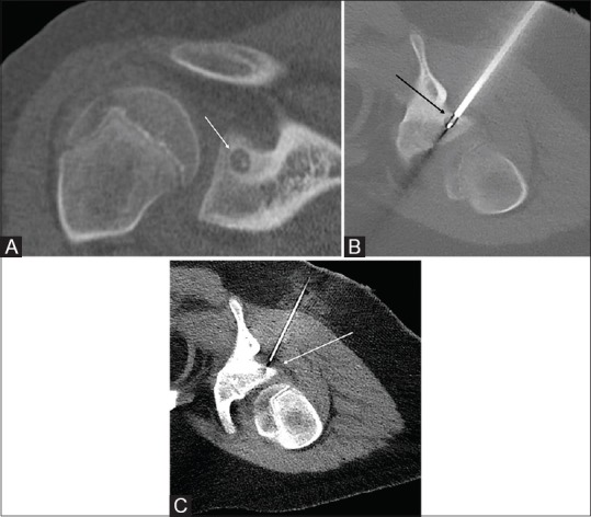 Figure 2 (A-C)