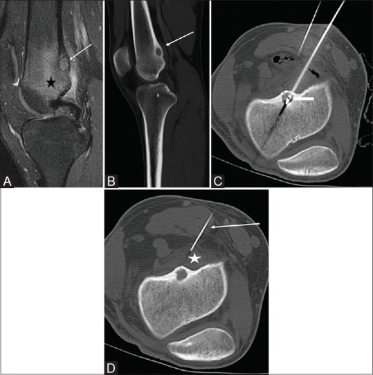 Figure 4 (A-D)