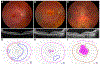 Figure 4 -