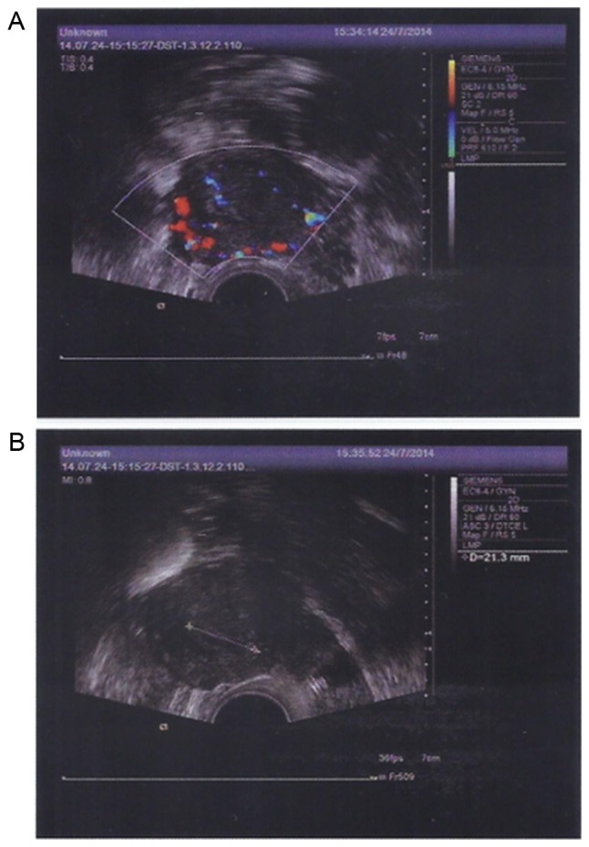 Figure 12.