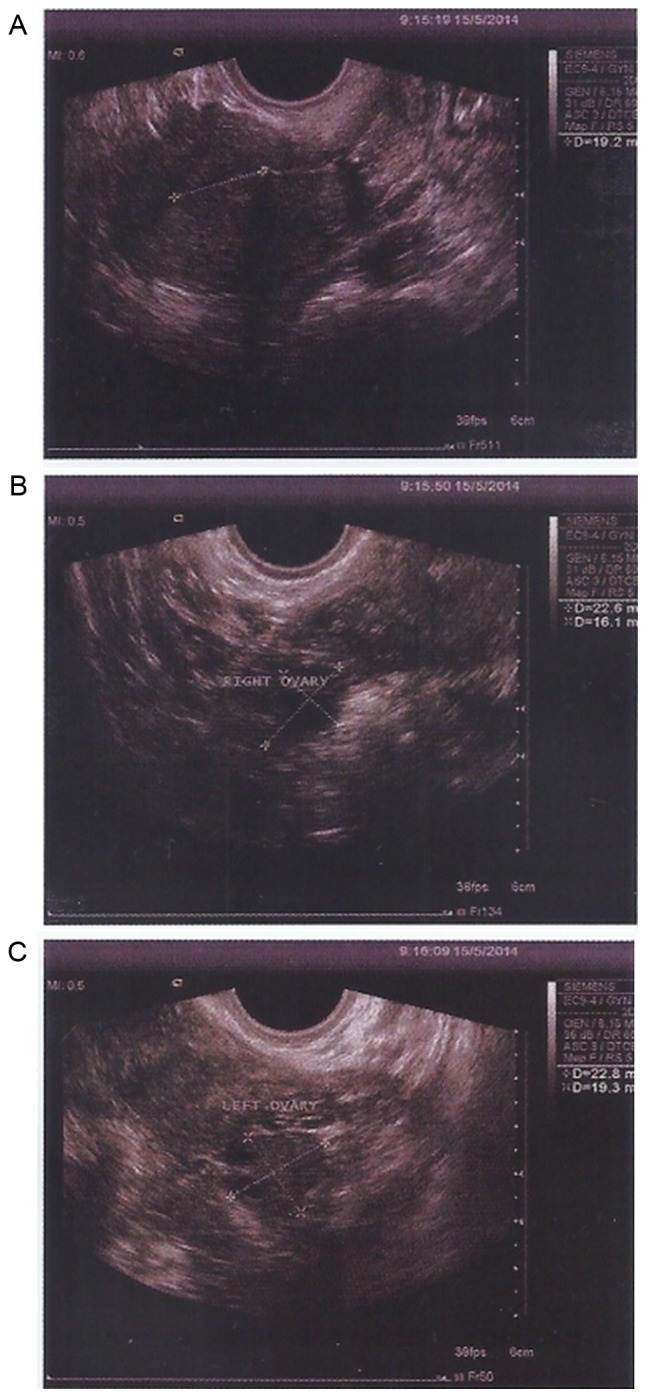 Figure 11.