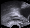 Fig. 17.