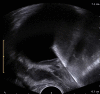Fig. 10.