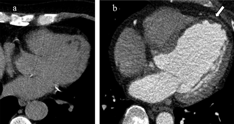 Figure 15.