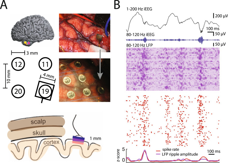 Fig. 4