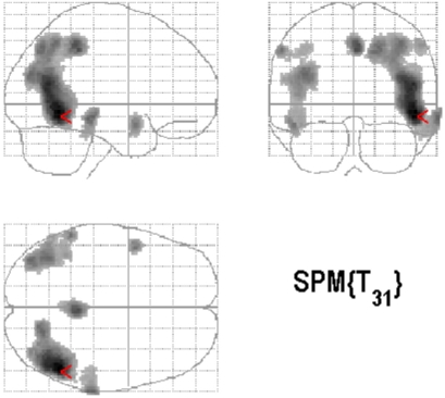 Figure 1A