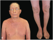 Fig 4