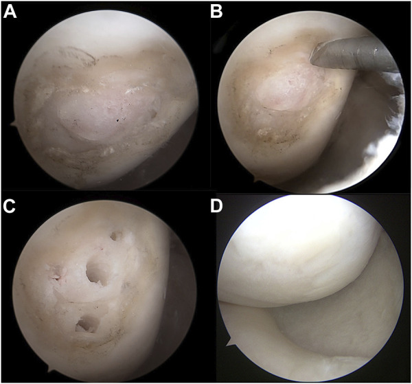 FIGURE 2