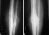 Fig. 3A–B