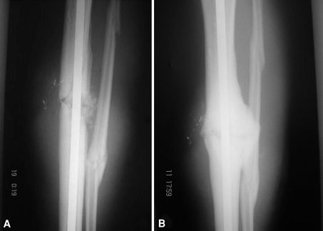 Fig. 3A–B