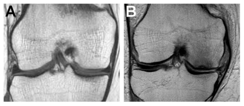 Fig. (3)