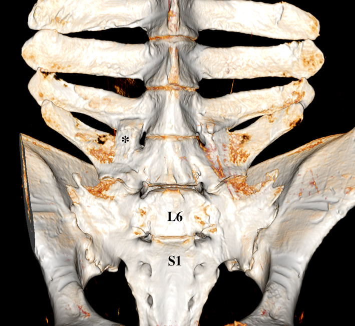 FIGURE 3