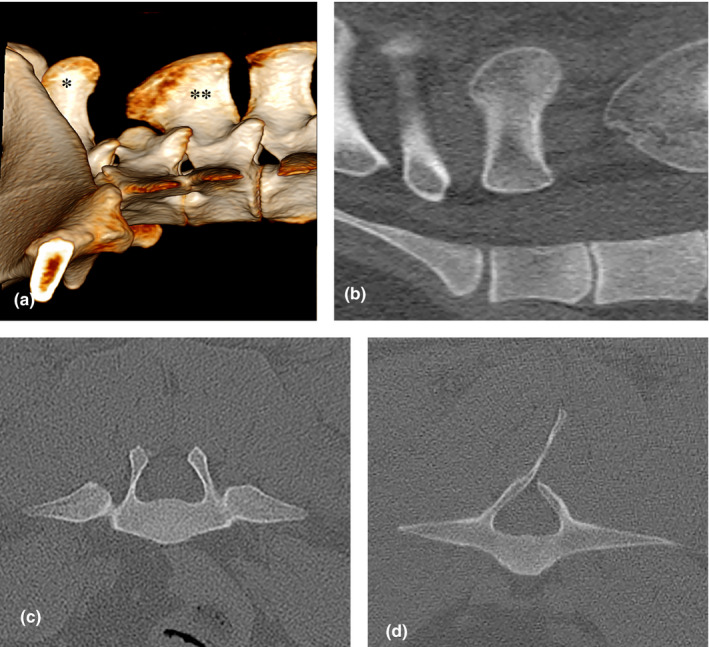 FIGURE 1