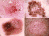 Fig 3
