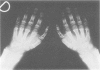 374