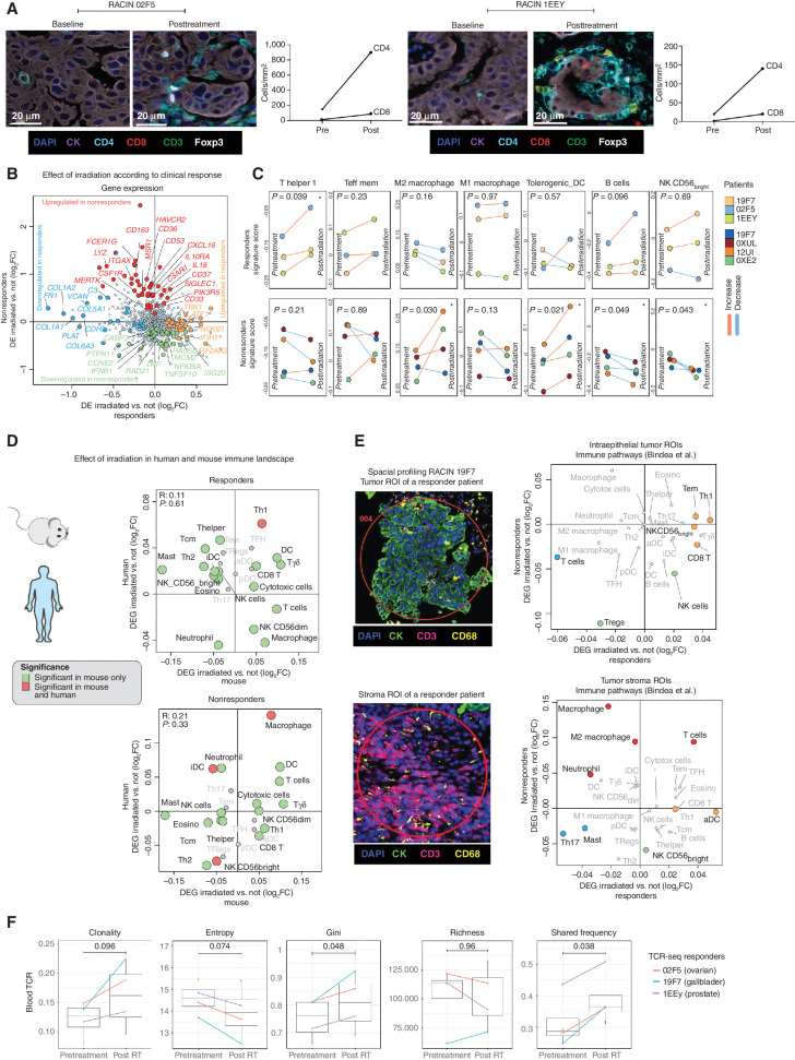 Figure 6. Effect of low-dose irradiation on tumor immune landscape. A, TILs before and after LDRT revealed by mIF imaging in two representative responding tumors. Left, representative mIF images (20× magnification; CK, pancytokeratin); right, quantification of CD4+ and CD8+ cells. B, Scatter plot showing differential gene expression between baseline and post-irradiation biopsy in responding (x-axis) versus nonresponding tumors (y-axis). The log2 of the fold change in median gene expression (log2FC) is shown (positive values indicate upregulation post-LDRT). Genes displaying a significant change (unadjusted P < 0.05) are color-coded as shown in the legend. C, Line plots showing the progression of immune gene signature scores from baseline to post-LDRT biopsies in responding versus nonresponding tumors. D, Scatter plot showing differential immune signature score analysis between baseline and post-irradiation biopsy in responding human tumors (x-axis) versus responding mouse (RACIM) ID8 tumors (y-axis; top) and between nonresponding human versus nonresponding (CIM) mouse tumors (bottom). E, NanoString GeoMx analysis of intraepithelial tumor immune infiltrates vs. tumor stroma immune infiltrates in responding versus nonresponding tumors. The log2 of the fold change in the median of the signature score (log2FC) is shown. Immune signature score displaying a significant change (unadjusted P < 0.05) is color-coded as depicted in the legend of B. F, Comparison of TCR CDR3 diversity by clonality, Shannon diversity entropy, Gini coefficient, richness, and shared frequency in three patients with responding tumors.