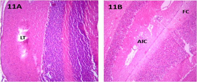 Figure 11.