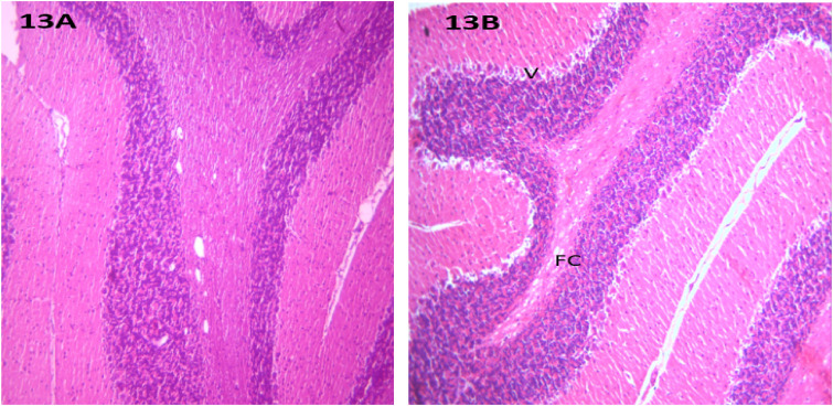 Figure 13.