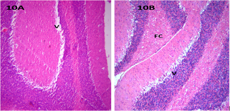 Figure 10.