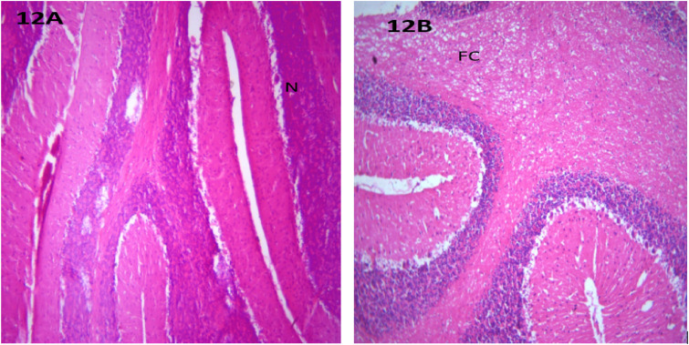Figure 12.