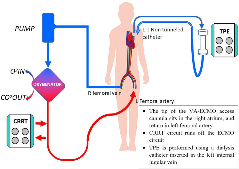 Figure 2