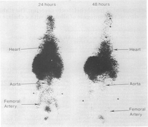 graphic file with name pnas00041-0026-a.jpg