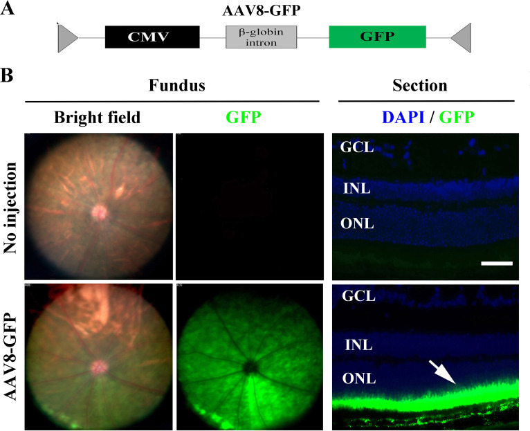 Figure 4—figure supplement 1.