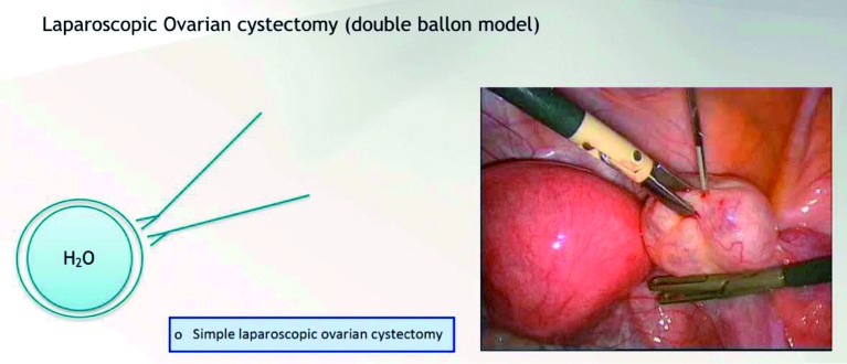 graphic file with name FVVinObGyn-10-21-g004.jpg