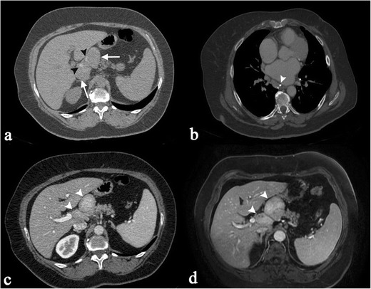 Fig. 9