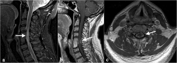 Fig. 15