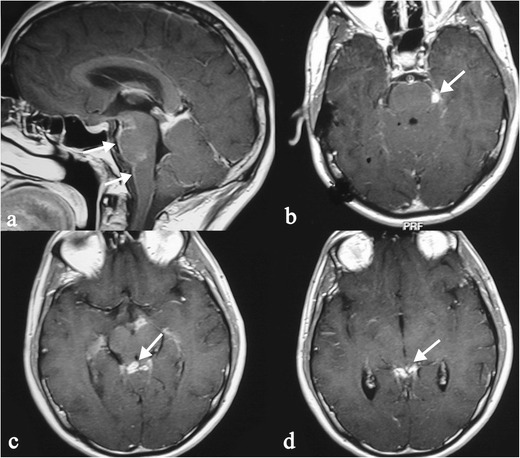 Fig. 14