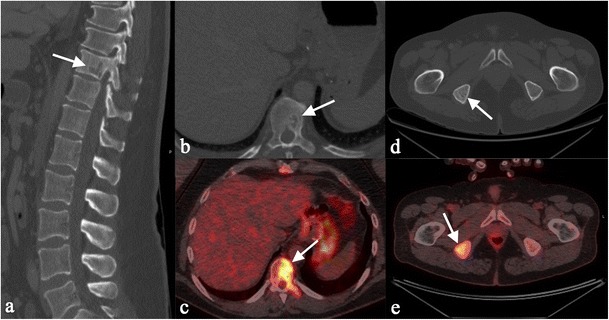 Fig. 17