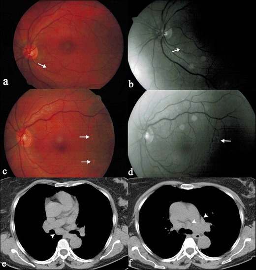 Fig. 20