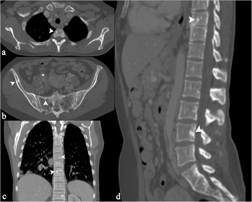 Fig. 18