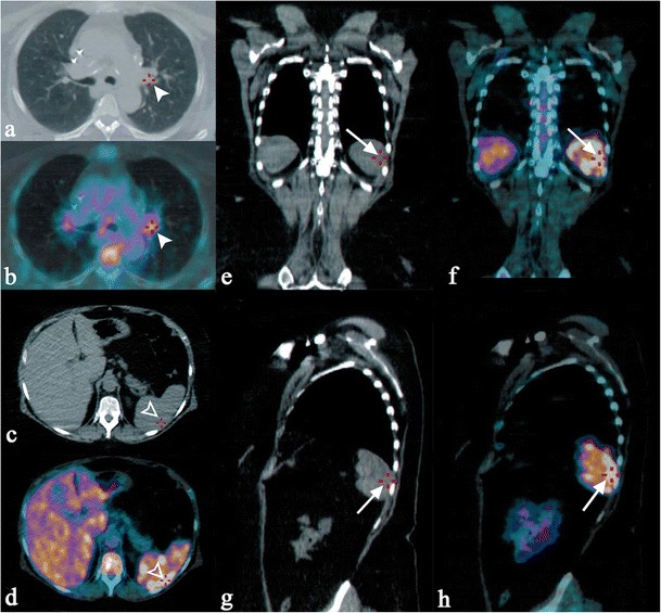 Fig. 6