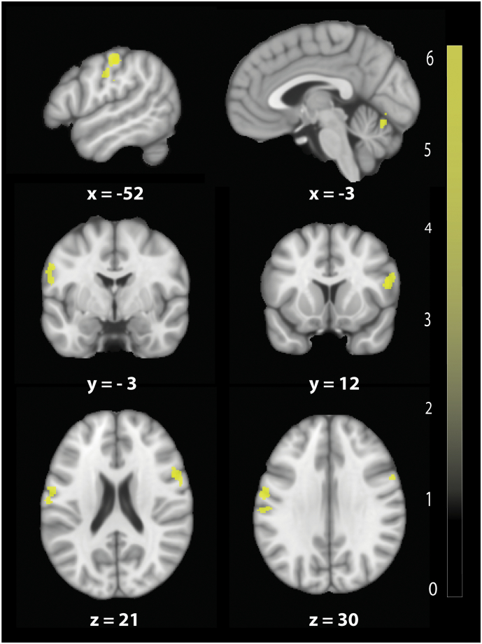 Fig. 3