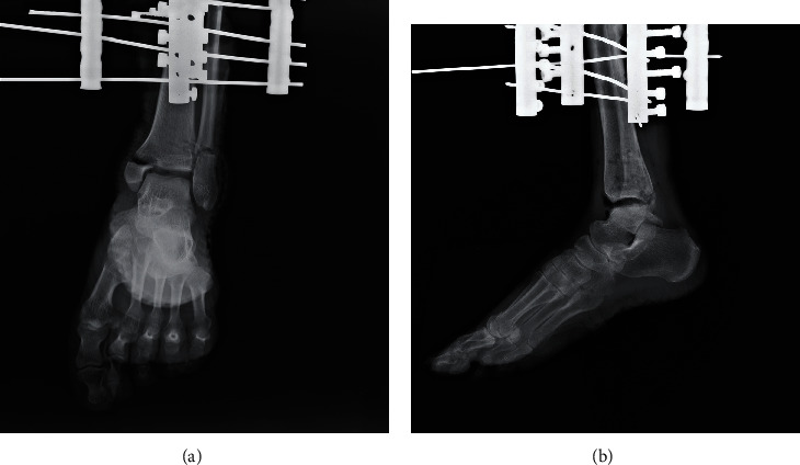 Figure 4