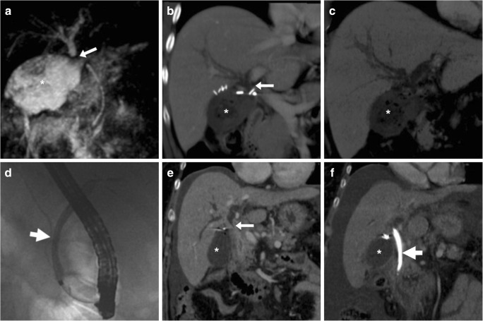 Fig. 18