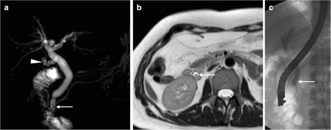 Fig. 15