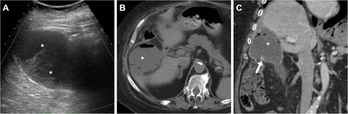 Fig. 10