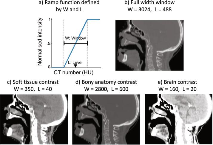 Fig. 2