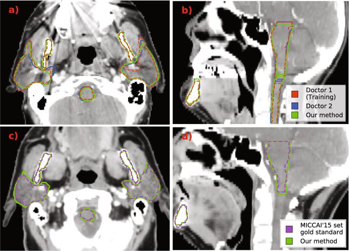 Fig. 4