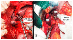 Figure 23